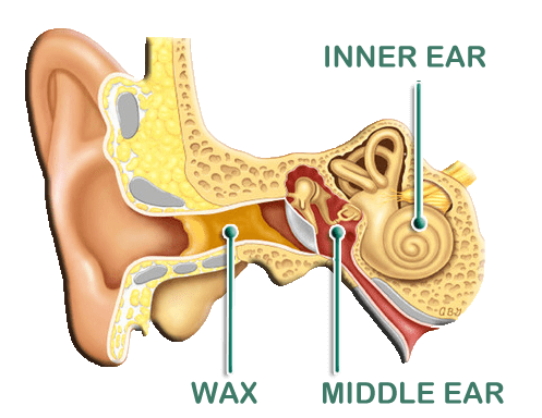 Diagram of the ear showing wax build-up location